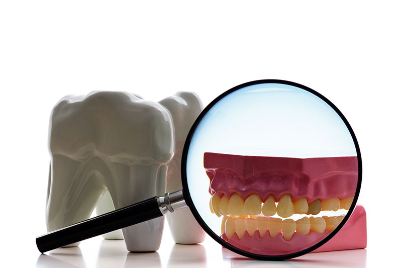 Root Canal Treatment in Waynesville