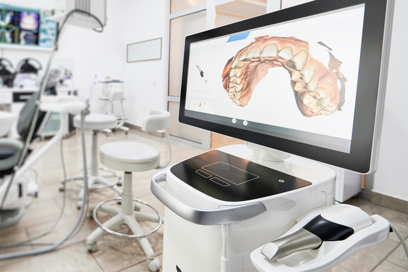 Intra-Oral Scanner in Waynesville